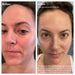 Clear Skin Advance Face Serum - Before & After