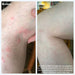 Healing Eczema Balm Before & After
